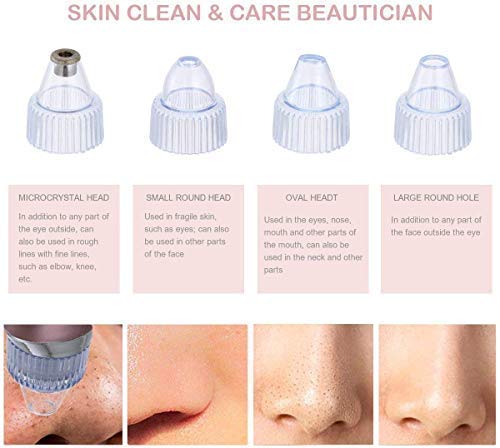 Derma Suction Pore Cleaning Device – Vacuum-Powered Facial Tool for Deep Pore Cleansing and Blackhead Removal Premium Quality Single Deals™