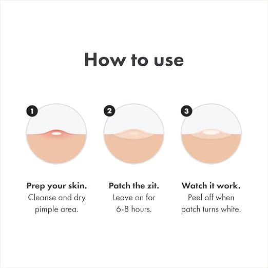 Hydrocolloid Acne Patch Set – 36-Piece Targeted Spot Treatment for Clear, Protected Skin Premium Quality Single Deals™