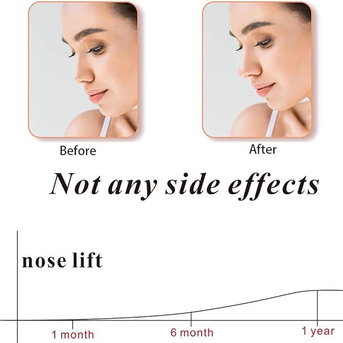 Nose Up Clip – Sophisticated Wellness Solution Premium Quality SingleDeals™