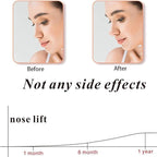 Nose Up Clip – Sophisticated Wellness Solution Premium Quality SingleDeals™