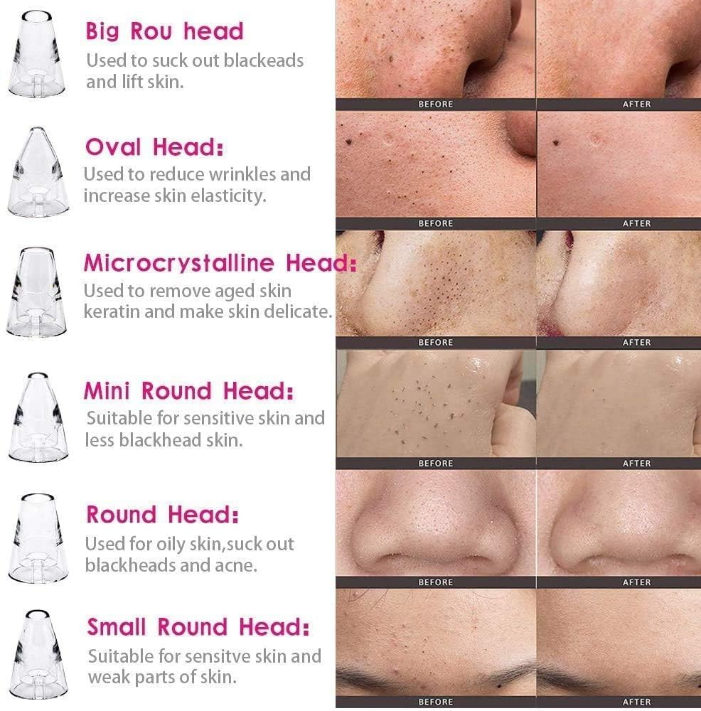 USB Multi-Functional Derma Suction – Professional Pore Cleaning & Blackhead Remover Device Premium Quality Single Deals™