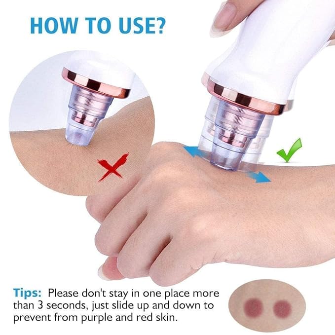 USB Multi-Functional Derma Suction – Professional Pore Cleaning & Blackhead Remover Device Premium Quality Single Deals™