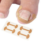 Ingrown Toenail Correction Patch -1 Strip  Professional Paronychia Treatment Sticker for Pain Relief and Nail Alignment Premium Quality Single Deals™