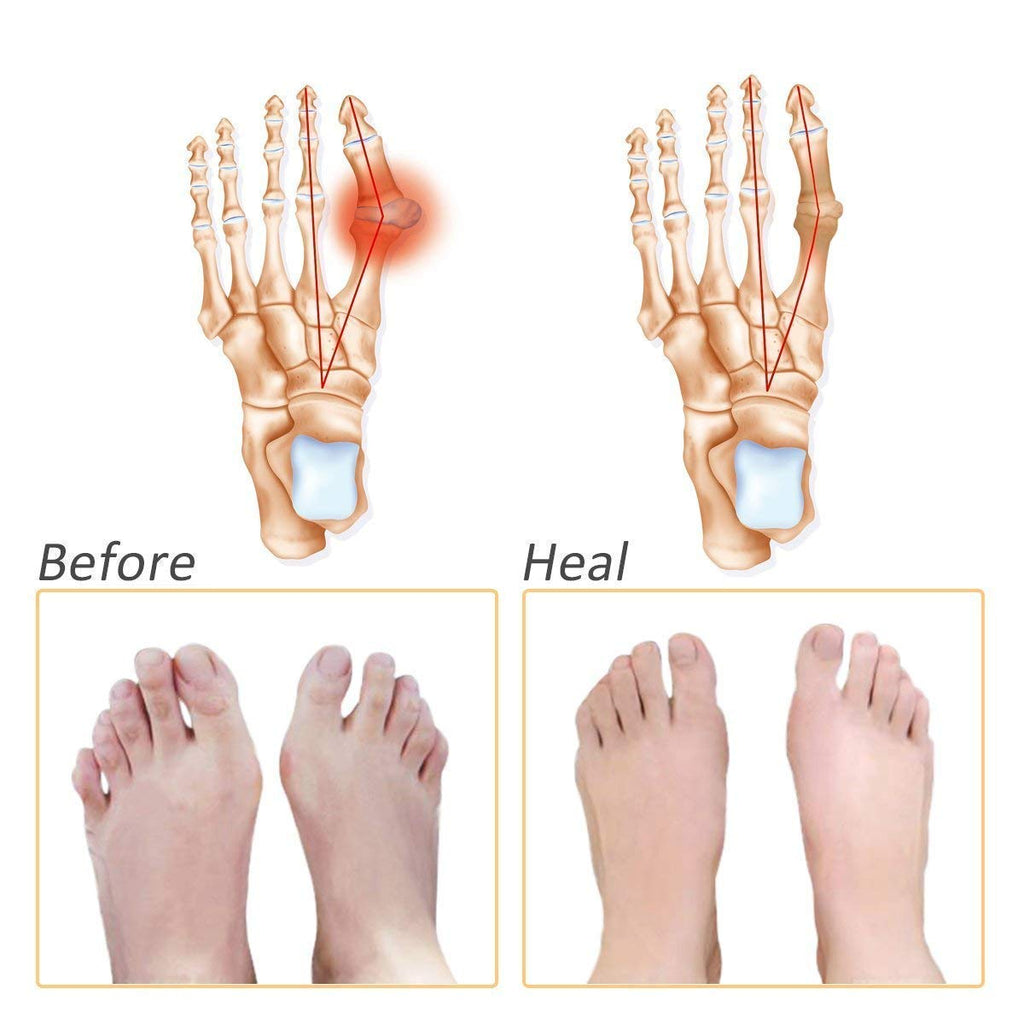 Comfortable Honeycomb Forefoot Cushion - Breathable Silicone Gel Pad for Pain Relief and All-Day Comfort in High Heels Premium Quality Single Deals™