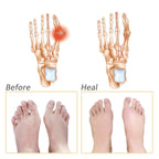 Comfortable Honeycomb Forefoot Cushion - Breathable Silicone Gel Pad for Pain Relief and All-Day Comfort in High Heels Premium Quality Single Deals™