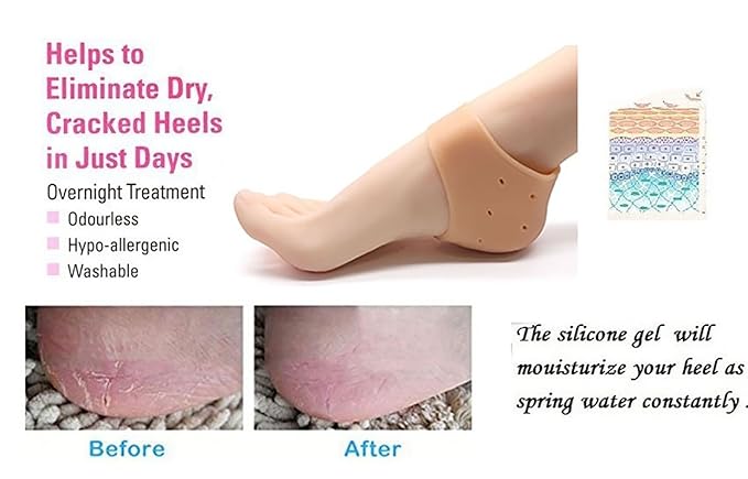 Moisturizing Silicone Gel Heel Sleeves - Breathable, Anti-Crack Protector Pads for Soft, Hydrated Heels Premium Quality Single Deals™
