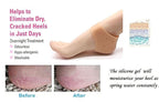 Moisturizing Silicone Gel Heel Sleeves - Breathable, Anti-Crack Protector Pads for Soft, Hydrated Heels Premium Quality Single Deals™