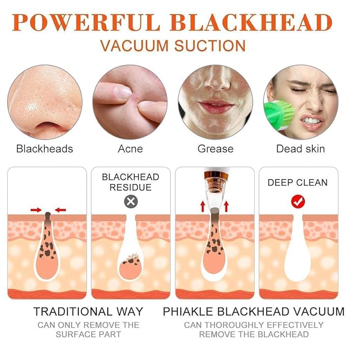USB Multi-Functional Derma Suction – Professional Pore Cleaning & Blackhead Remover Device Premium Quality Single Deals™