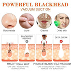 USB Multi-Functional Derma Suction – Professional Pore Cleaning & Blackhead Remover Device Premium Quality Single Deals™