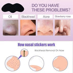 10Pcs Blackhead Removal Nasal Patch – Sophisticated Skin Care Solution Premium Quality SingleDeals™