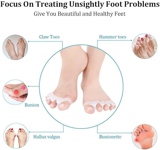 Silicone Gel Bunion Toe Corrector - Comfortable Orthopedic Toe Separator and Straightener for Pain Relief and Alignment Premium Quality Single Deals™