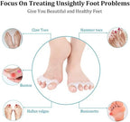 Silicone Gel Bunion Toe Corrector - Comfortable Orthopedic Toe Separator and Straightener for Pain Relief and Alignment Premium Quality Single Deals™