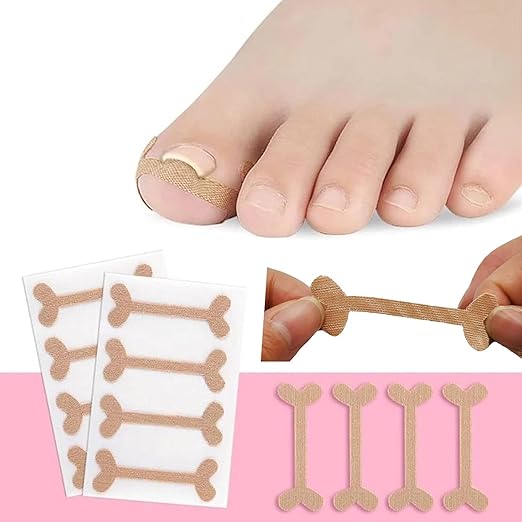 Ingrown Toenail Correction Patch -1 Strip  Professional Paronychia Treatment Sticker for Pain Relief and Nail Alignment Premium Quality Single Deals™