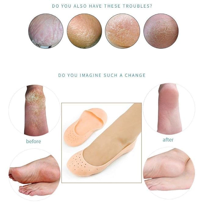 Moisturizing Full Silicone Heel & Foot Socks - Breathable, Anti-Crack Treatment Sleeves for Smooth, Hydrated Skin Premium Quality Single Deals™
