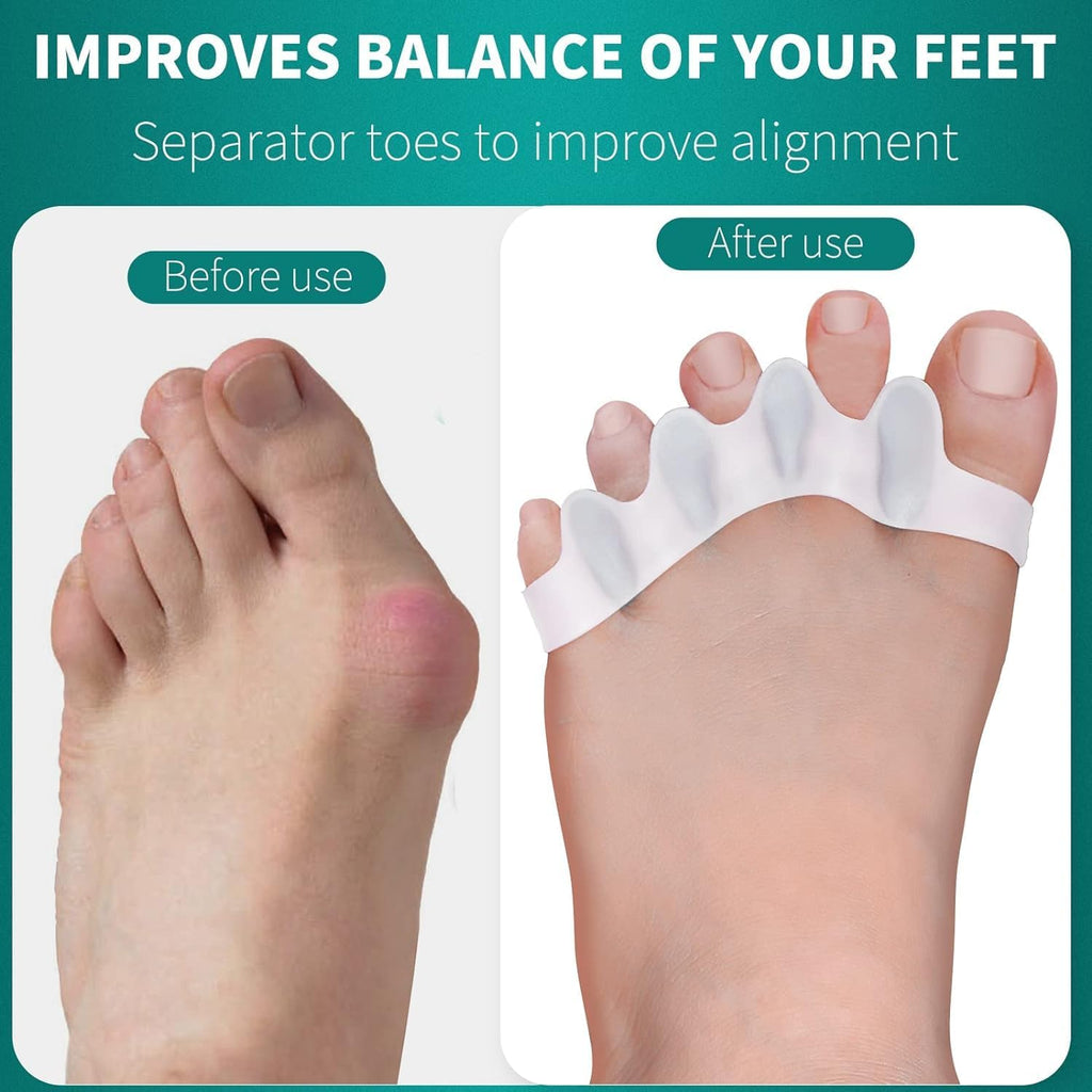 Silicone Gel Bunion Toe Corrector - Comfortable Orthopedic Toe Separator and Straightener for Pain Relief and Alignment Premium Quality Single Deals™