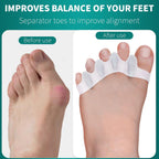Silicone Gel Bunion Toe Corrector - Comfortable Orthopedic Toe Separator and Straightener for Pain Relief and Alignment Premium Quality Single Deals™