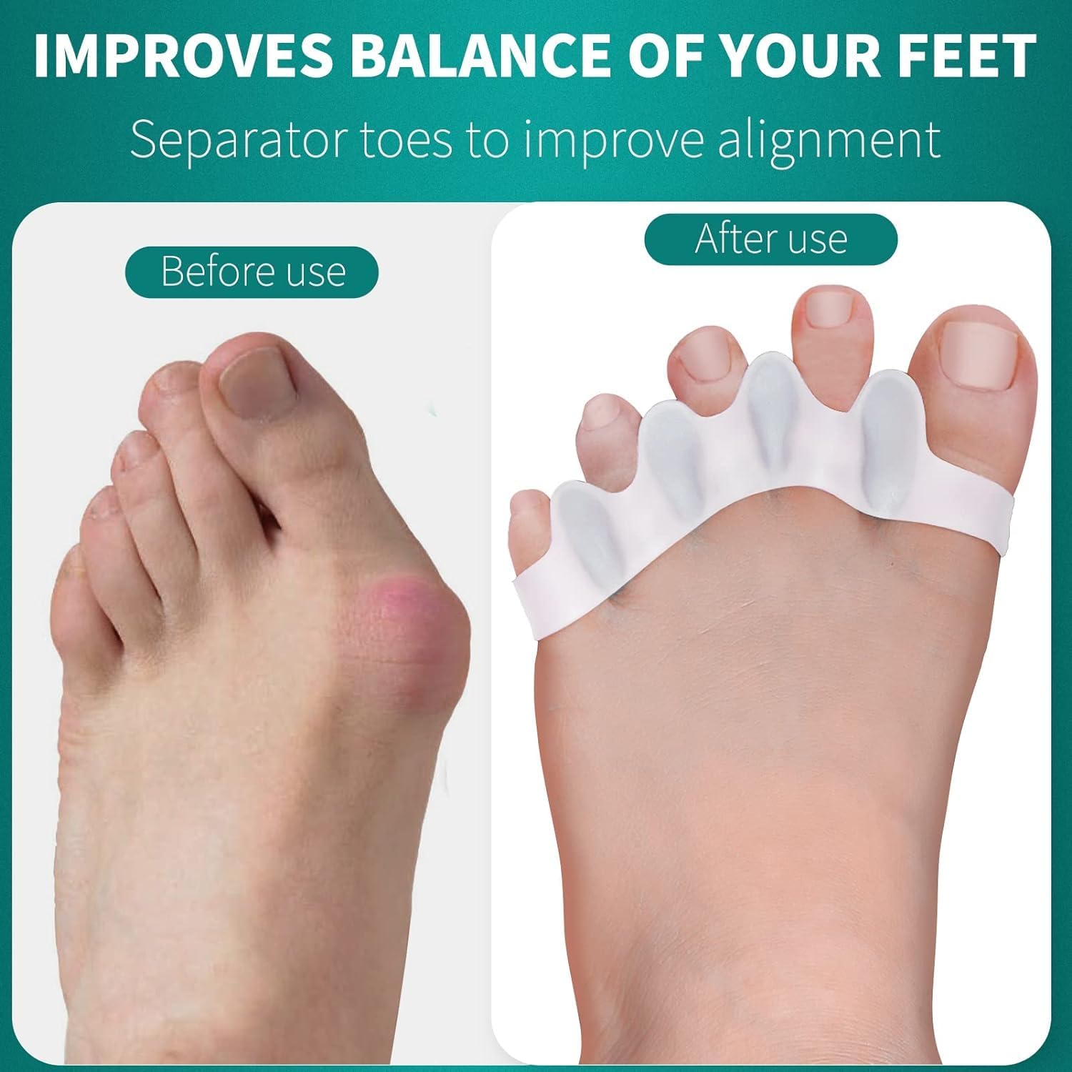 Silicone Gel Bunion Toe Corrector - Comfortable Orthopedic Toe Separator and Straightener for Pain Relief and Alignment Premium Quality Single Deals™
