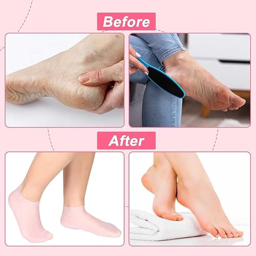 100g Moisturizing Silicone Gel Spa Socks 1 Pair  – Reusable Hydrating Treatment for Soft, Smooth Feet Premium Quality Single Deals™