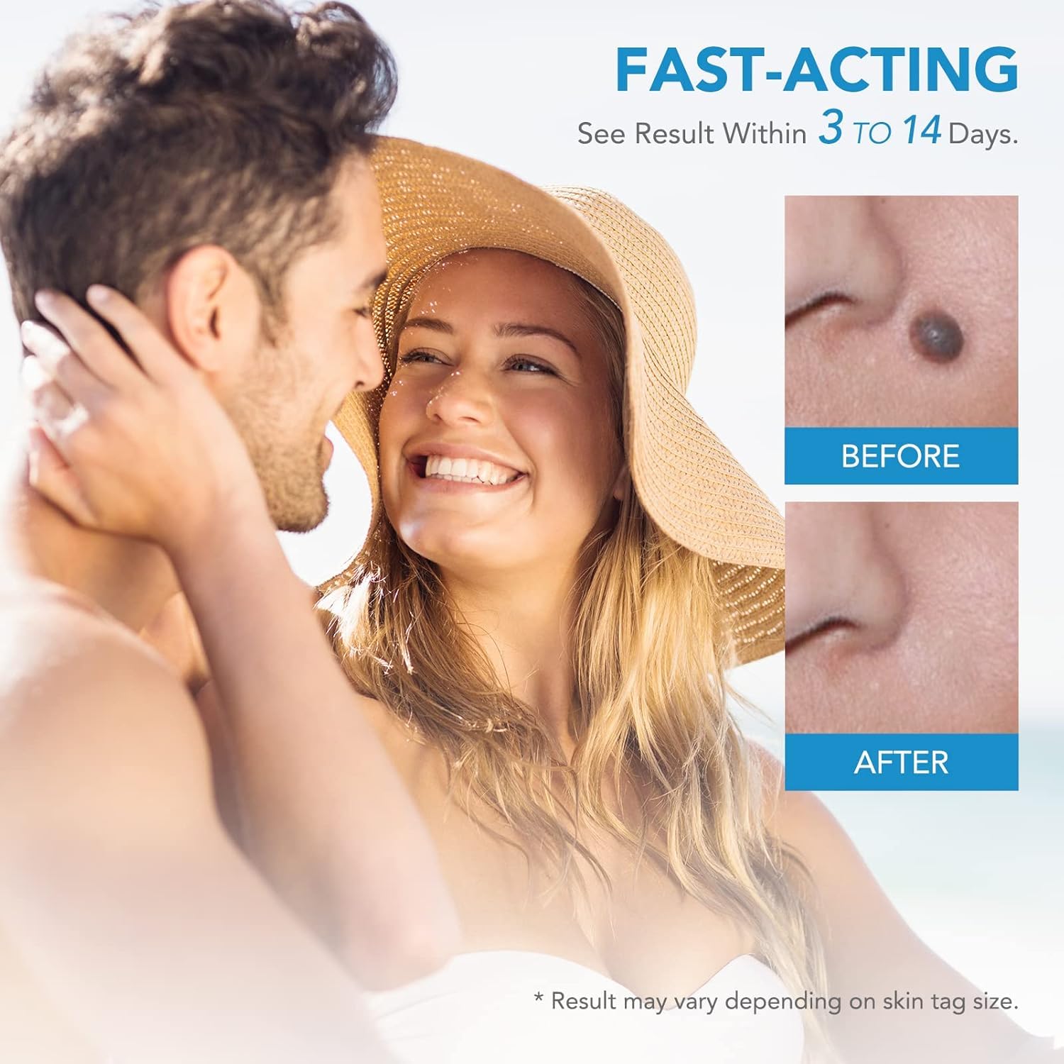 Auto Skin Tag Remover Kit – Sophisticated Personal Care Solution Premium Quality SingleDeals™