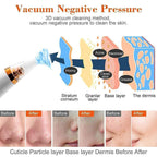 USB Multi-Functional Derma Suction – Professional Pore Cleaning & Blackhead Remover Device Premium Quality Single Deals™
