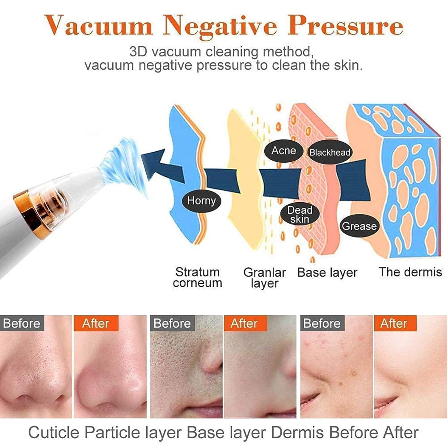 USB Multi-Functional Derma Suction – Professional Pore Cleaning & Blackhead Remover Device Premium Quality Single Deals™