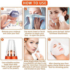 USB Multi-Functional Derma Suction – Professional Pore Cleaning & Blackhead Remover Device Premium Quality Single Deals™